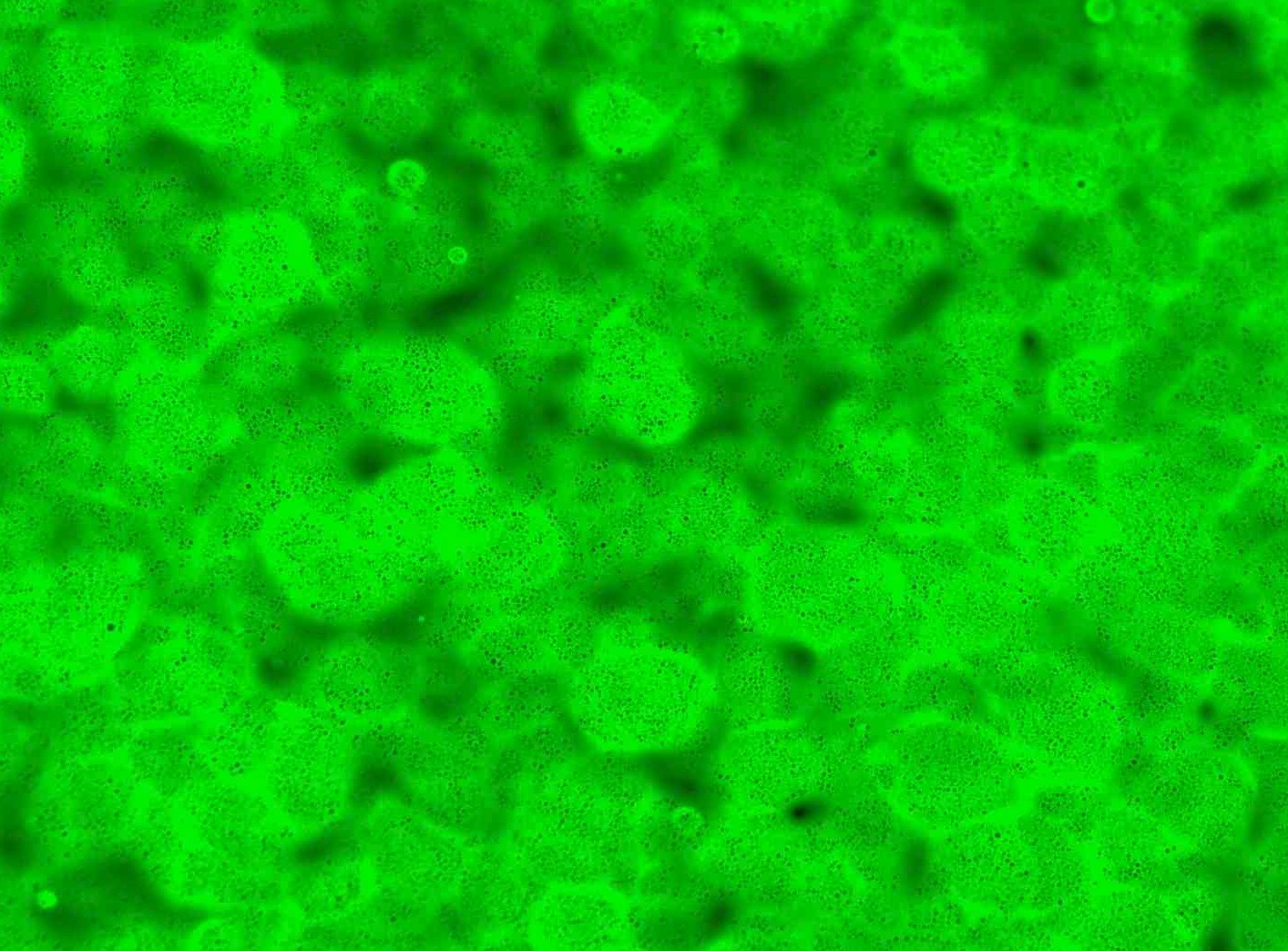 This image shows a filler that also fluoresces green (blue excitation light, green fluorescence; FITC filter). The small black dots in it are tiny beads of bitumen. Magnification 50x.