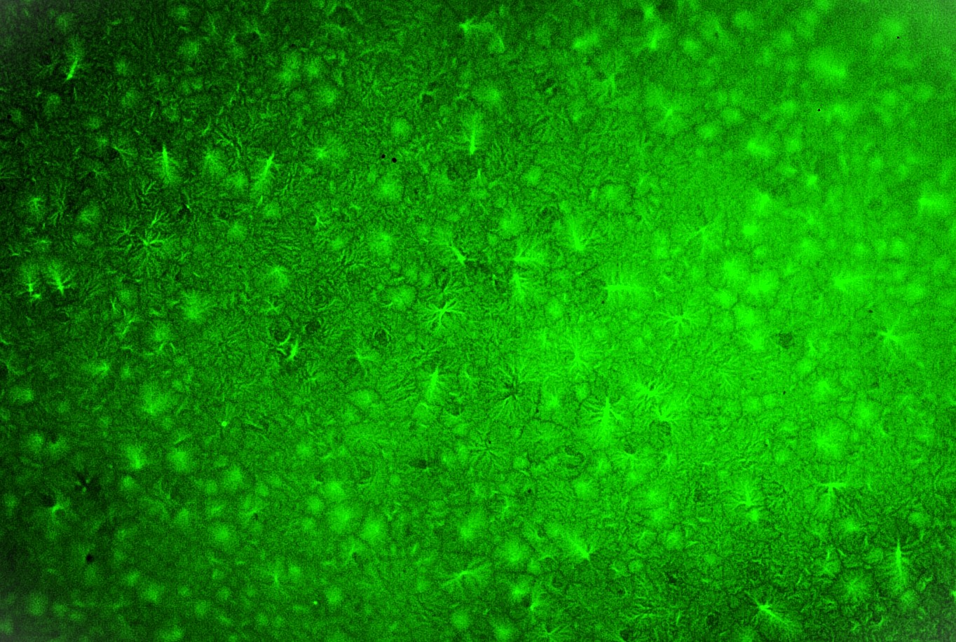 Here the green fluorescence (blue excitation light, green fluorescence; FITC fluorescence filter) of an aggregate with a tree root-like (dendritic) structure. This phenomenon is also mentioned in passing in the text. Magnification 200x.